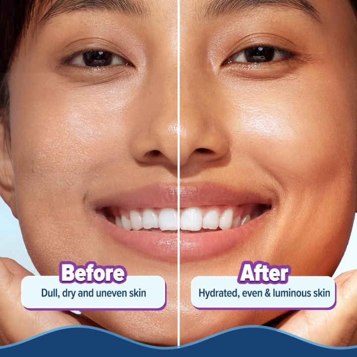Aqualogica%20Illuminate%20+%20Hydra%20Gel%20Moisturizer%20with%20Wild%20Berries%20&%20Alpha%20Arbutin-200g%7C24%20Hour%20Intense%20Hydration%7CWater-Like%20Gel%20Texture%7CNon-Sticky%20&%20Quick%20Absorbing%20for%20Luminous%20Skin%20-%20Image%206