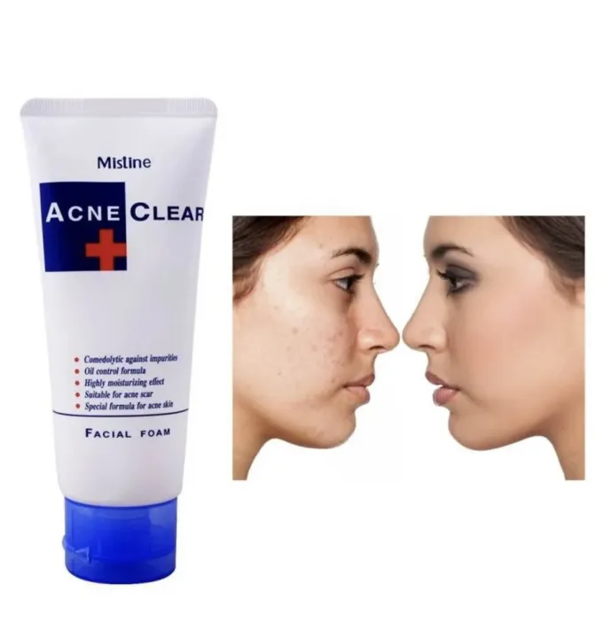 Mistine%20Acne%20Clear%20Facial%20Foam%2085%20ml%20-%20Image%202
