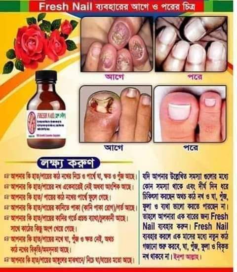 FRESH NAIL FOR NAIL PROBLEM