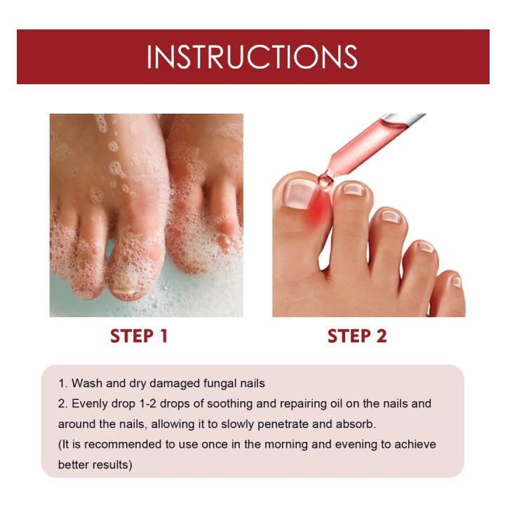 German%20ToenailPlus%E2%84%A2%20Anti%20Paronychia%20Relief%20Oil%20-%2010ML%20-%20Image%205