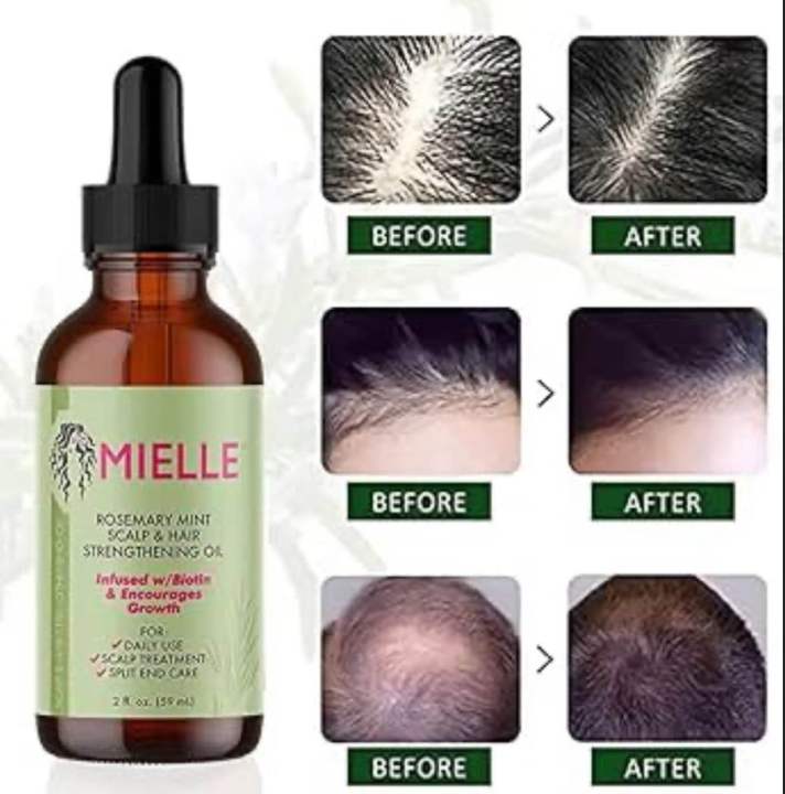 Mielle%20Organics%20Rosemary%20Hair%20Oil%20for%20Hair%20Growth%20Mint%20Scalp%20&%20Hair%20Strengthening%20Oil%20for%20All%20Hair%2059%20ML(100%25original)%20-%20Image%202