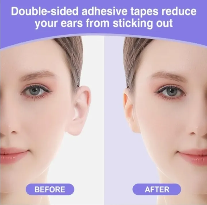 10%20Pcs%20Ear%20Corrector%20Sticker%20Stronger%20Ear%20Tape%20Patches%20Double%20sided%20Adhesive%20to%20Hold%20Back%20Protruding%20Ears%20-%20Image%204
