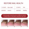 German ToenailPlus™ Anti Paronychia Relief Oil - 10ML.
