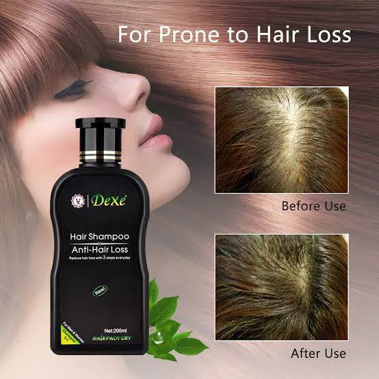 DEXE%20Anti-Hair%20Loss%20Hair%20Growth%20Shampoo%20Treatment%20Natural%20Ingredients%20200ml%20-%20Image%204