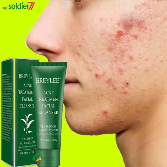 Breylee%20Salicylic%20skin%20care%20product%20Acid%20Acne%20Face%20Wash%20-%20100g%20(%20imported%20100%20%25%20Authentic%20product%20)%20-%20Image%203