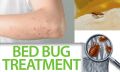 Bed Bug Treatment / Pest Control per room. 
