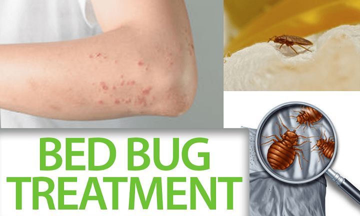 Bed%20Bug%20Treatment%20/%20Pest%20Control%20per%20room%20-%20Image%207