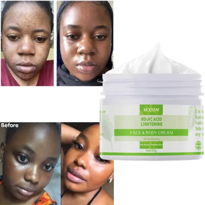 MOOYAM%20Kojic%20Acid%20Lightening%20Face%20&%20Body%20Cream%20(60g)%20-%20Image%203