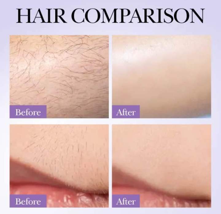 Hair%20Removal%20Cream%20Inhibits%20Hair%20Growth%20Whitening%20Safe%20Gentle%20Spray%20Effectively%20Remove%20Armpit%20Knee%20Leg%20Hair%20Skincare%20Products%20-%20Image%202