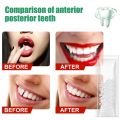Resin Tooth Repair Glue Shapeable Teeth Gaps Filling Solid Glue Temporary Teeth Repair Falseteeth Glue Safety Dental Supplies. 