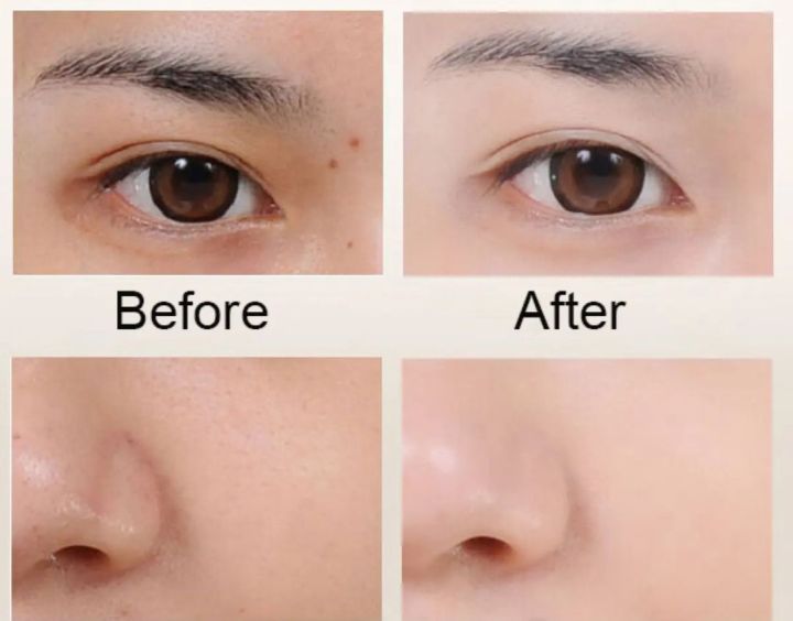 Paimei%20Anti%20Spot%20Night%20Cream%2025g%20Skin%20Care%20Face%20Cream%20Remove%20Pigment%20-%20Image%202