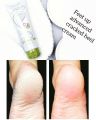 "Feet Up Advanced Cracked Heel Repair Cream by Oriflame". 