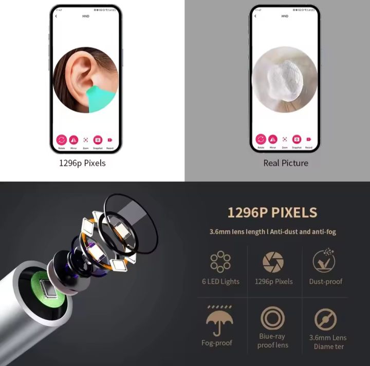 Visual%20Ear%20Cleaner%20with%20Camera,%20Wireless%20Earpicks,%20Otoscope,%20USB%20C%20Charging,%20Endoscope,%20Earwax%20Removal%20Tools,%20Mini%20Camera%20-%20Image%205