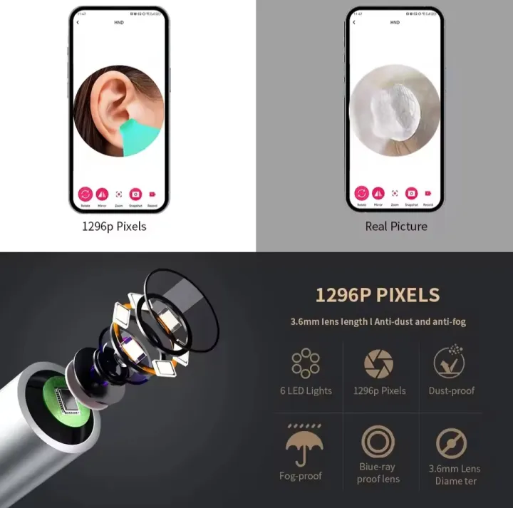 Visual%20Ear%20Cleaner%20with%20Camera,%20Wireless%20Earpicks,%20Otoscope,%20USB%20C%20Charging,%20Endoscope,%20Earwax%20Removal%20Tools,%20Mini%20Camera%20-%20Image%205