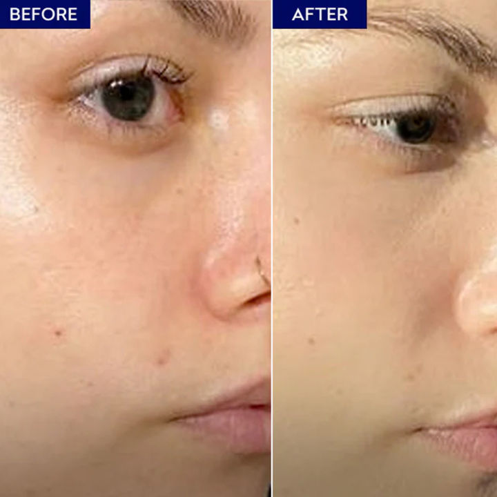 Jenpharm%20-%20Dermive%20Oil%20Free%20Moisturizer%20100ml%20-%20Image%205