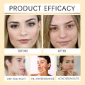 Centella Asiatica Cleansing Oil Makeup Remover Refreshing Clean Pores Oil Control Hydration Gentle Soothing Cleanser Facial Care.