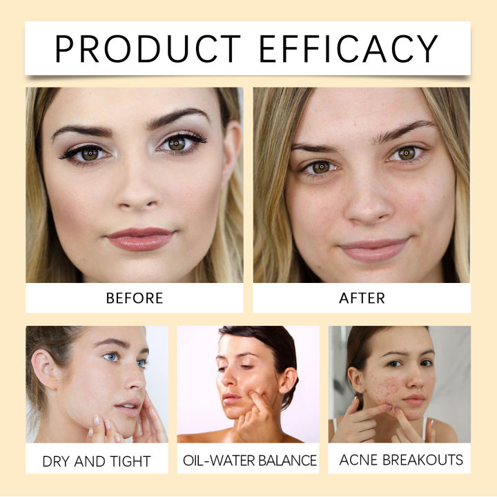 Centella%20Asiatica%20Cleansing%20Oil%20Makeup%20Remover%20Refreshing%20Clean%20Pores%20Oil%20Control%20Hydration%20Gentle%20Soothing%20Cleanser%20Facial%20Care%20-%20Image%205