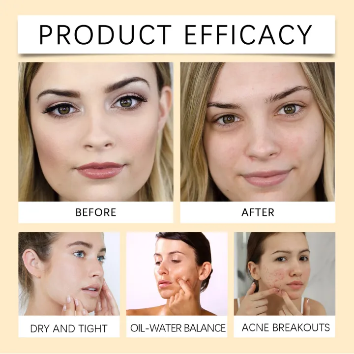 Centella%20Asiatica%20Cleansing%20Oil%20Makeup%20Remover%20Refreshing%20Clean%20Pores%20Oil%20Control%20Hydration%20Gentle%20Soothing%20Cleanser%20Facial%20Care%20-%20Image%205
