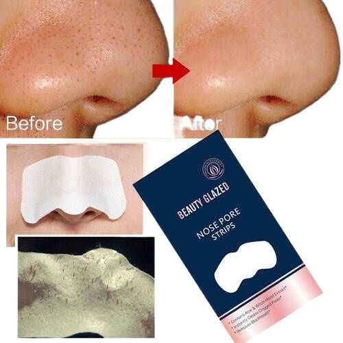 Beauty%20Glazed%20-%2010pcs%20Glazed%20Nose%20Pore%20Strips%20Blackhead%20Remover%203gm%20-%20Image%202