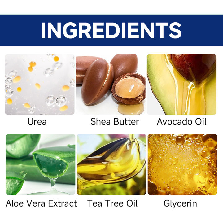 SUYARUN%2060%25%20Urea%20Foot%20Cream%20for%20Cracked%20Heels%20&%20Dry%20Skin%20-%20Intensive%20Moisturizing%20Treatment,%20Callus%20Remover,%20Diabetic%20Foot%20Care.%20freshfeet%20-%20Image%202