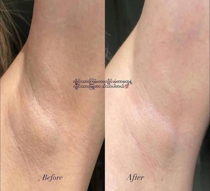 Dove%20Ultimate%20Repair%20Darkmarks%20Corrector%20Roll%20On%20Stick%20%7B%20Uk%20Made%20%7D%20-%20Image%202