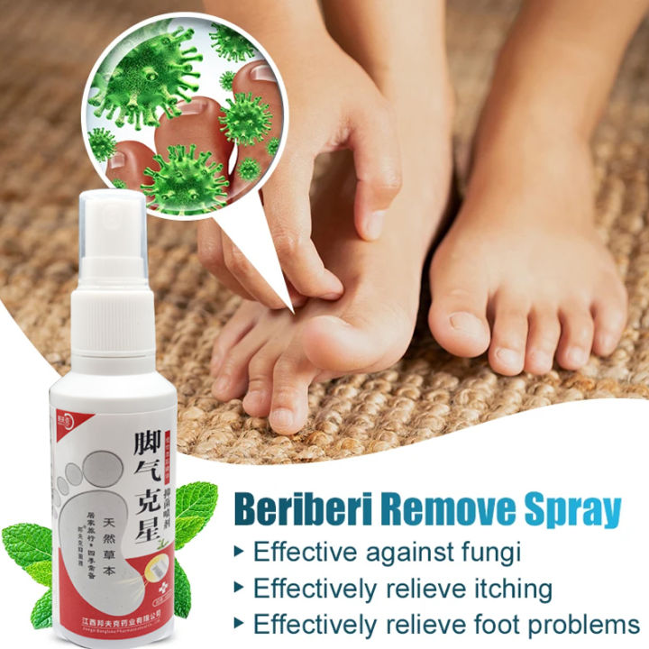 1Pcs%20Anti%20Fungal%20Foot%20Spray%20Foot%20Odor%20Remover%20Athlete%20Foot%20Medical%20Liquid%20Eczema%20Itching%20Onychomycosis%20Treatment%20Foot%20Care%20freshfeet%20-%20Image%202