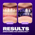Hismile V34 Colour Corrector Serum (Teeth Whitening/Brightening). 