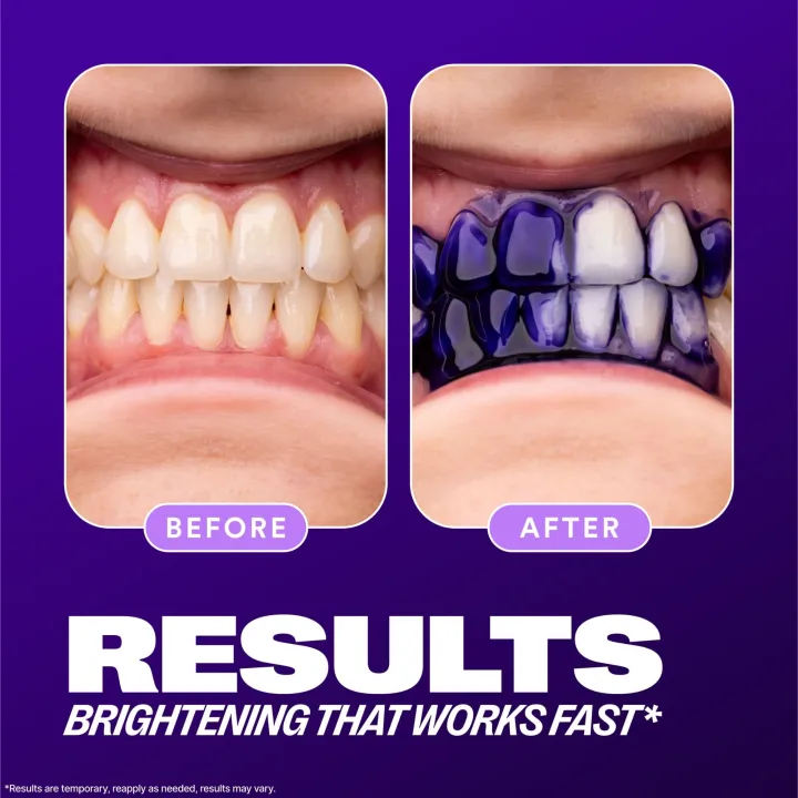 Hismile%20V34%20Colour%20Corrector%20Serum%20(Teeth%20Whitening/Brightening)%20-%20Image%205