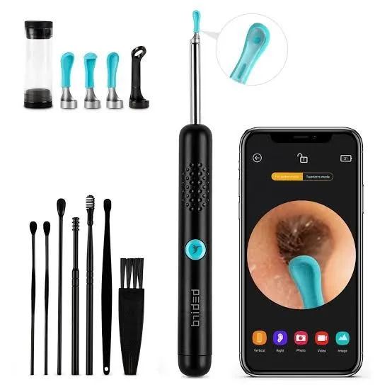 This%20Earwax%20Removal%20Camera%20Is%20Equal%20Parts%20Satisfying%20And%20Disgusting%20-%20Image%205