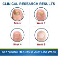 7DAYS Repair Nail Fungus Treatments Essence Foot Care Serum Toe Nails Fungal Removal Gel Anti-Infection freshfeet. 