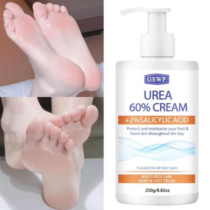GSWP 60% Urea Moisturising Hand and Foot Cream, containing salicylic acid, protects and nourishes hands and feet.250g/500g