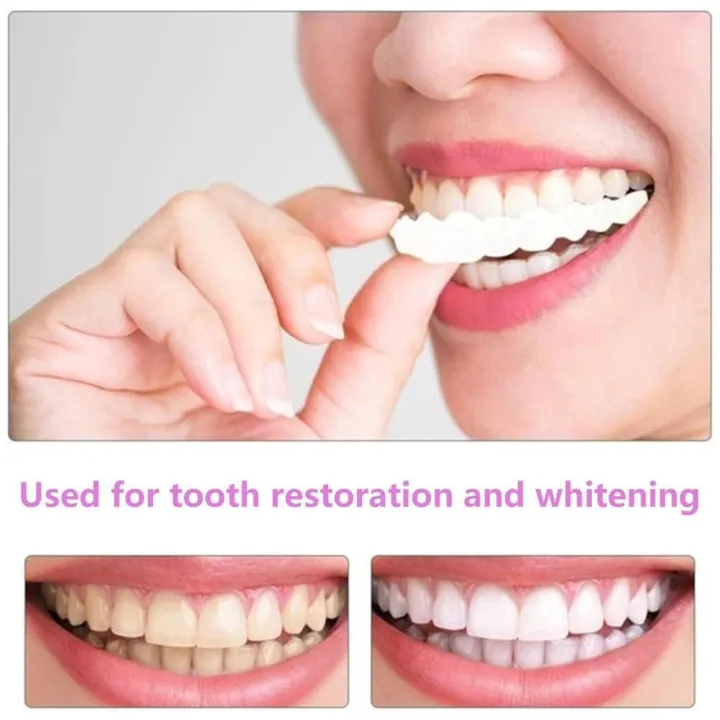 1%20pair%20Teeth%20Veneers%20Men%20Women%20Brightening%20Dentures%20Temporary%20False%20Teeth%20Cover%20Instant%20Imitation%20Braces%20For%20Confidence%20Smile%20-%20Image%203