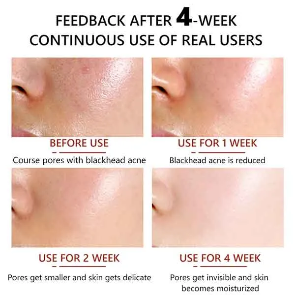 Vibrant%20Glamour%20Pore%20Minimizer%20Serum%2030ml%20-%20Image%207