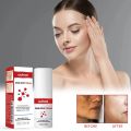 Ouhoe Dark Spot Cream 30ml. 