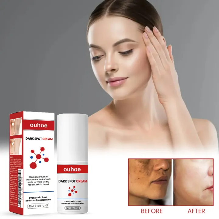 Ouhoe%20Dark%20Spot%20Cream%2030ml%20-%20Image%202
