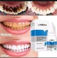 LANBENA  Teeth  whitening essence(দাত সাদা করবে)  original ptoduct 10 ml.. 