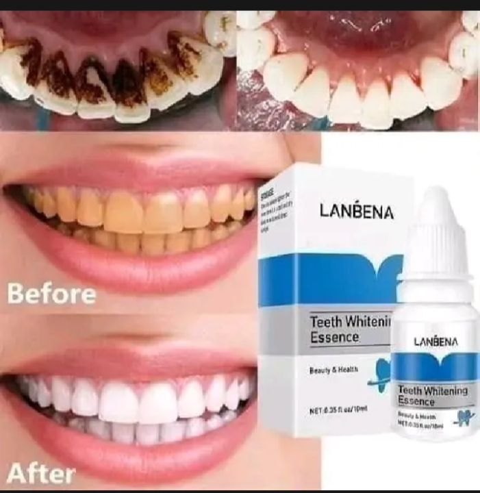 LANBENA%20%20Teeth%20%20whitening%20essence(%E0%A6%A6%E0%A6%BE%E0%A6%A4%20%E0%A6%B8%E0%A6%BE%E0%A6%A6%E0%A6%BE%20%E0%A6%95%E0%A6%B0%E0%A6%AC%E0%A7%87)%20%20original%20ptoduct%2010%20ml.%20-%20Image%203