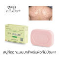 Genuine 💯   Zudaifu Sulfur Soap Chinese Herbal Soap Bar Soap Sulfur Soap Antifungal Soap Natural Whitening Skin Care 80g. 