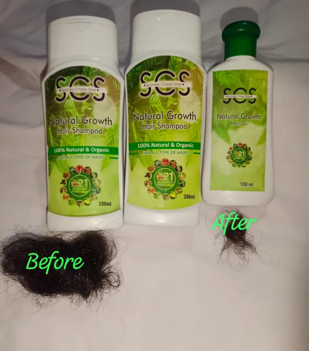 NATURAL%20GROWTH%20HAIR%20OIL&%20NATURAL%20GROWTH%20HAIR%20SHAMPOO%20scs%20-%20Image%203