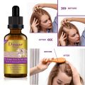 Disaar Anti-Hair Loss Hair Essential oil 30g (Ginger). 