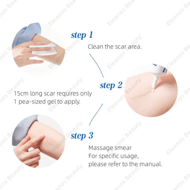 %F0%9F%8D%80Fast%20Delivery%F0%9F%8D%80Dermatix%20ultra%20gel%20advance%20scar%20Formular%2015g%20100%25%20genuine%20-%20Image%205