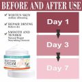 WHITENING CREAM skin lightening FOR intimate area private parts and underarm Whitening Cream for Men & Women Skin Brightening, Moisturizing & Dark Spot Removal Face & Body Lightening Cream for Underarms, Knees, Elbows & Private Areas. 