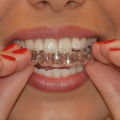 Silicone Mouth Guard Teeth Protector Night Guard Mouth Tray for Bruxism Grinding Non-snoring Teeth Protection.