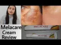 Melacare face cream 25g. 