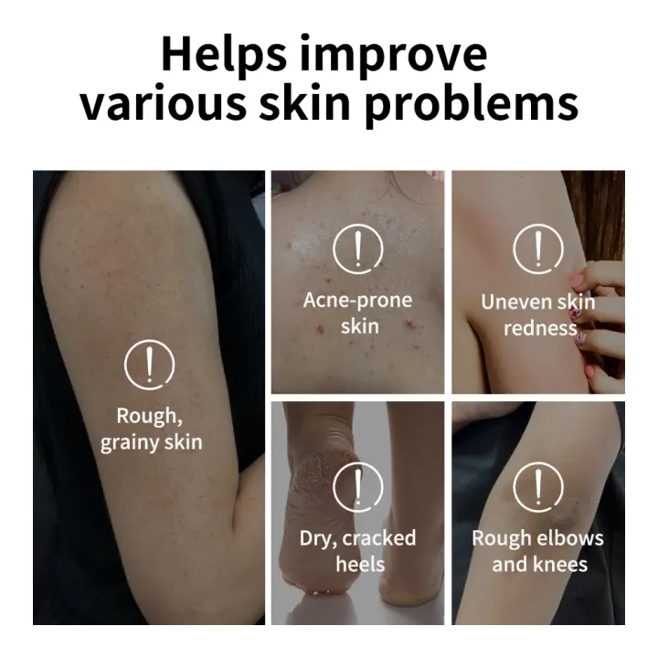 Glycolic%20Acid%20Exfoliating%20Body%20Stick%20Smooth%20Soften%20Rough%20Bumpy%20Skin%20Deep%20Hydration%20Even%20Delicate%20Skin%20Tone%20Exfoliating%20Stick%20-%20Image%205