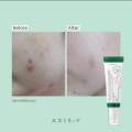 AXIS -Y Dark Spot Correcting Glow Serum Niacinamide 5% Squalane Hippophae Rhamnoides Fruit Extract 50ml. 