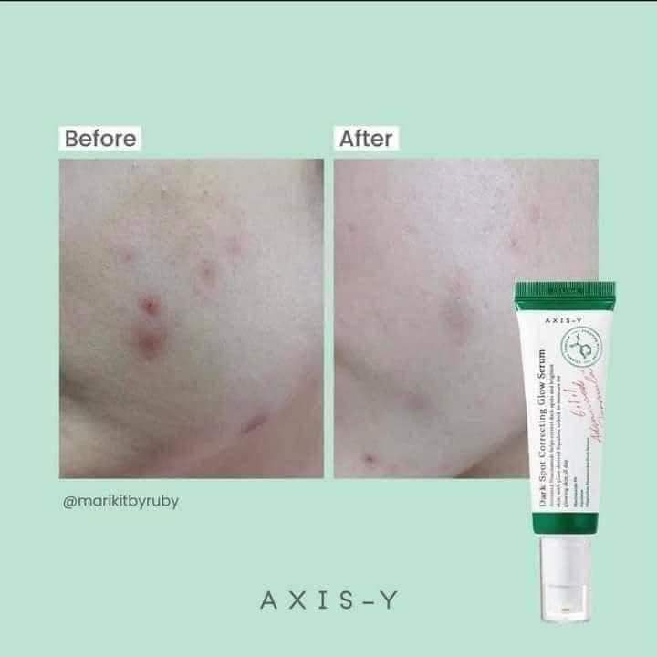 AXIS%20-Y%20Dark%20Spot%20Correcting%20Glow%20Serum%20Niacinamide%205%25%20Squalane%20Hippophae%20Rhamnoides%20Fruit%20Extract%2050ml%20-%20Image%203