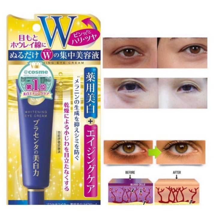 Meishoku%20Eye%20Cream%20Place%20Whiter%20Medicinal%20Whitening%20Eye%20Cream%20Cosme%20Award%20Winner%20Made%20In%20Japan%20-%20Image%202