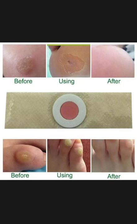 Corn%20Cap%2010%20pieces%20-%20Image%203