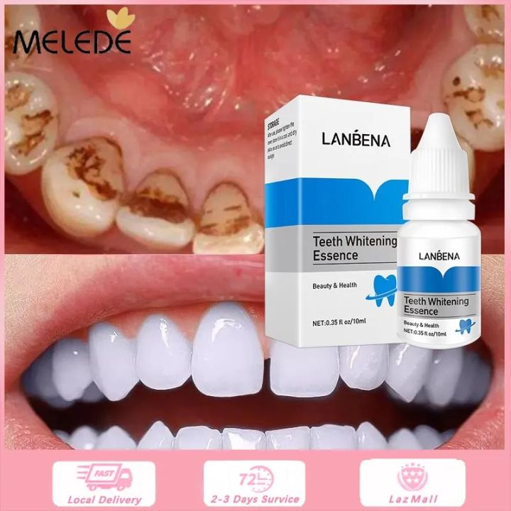 Lanbena%20Teeth%20Whitening%20Essence-0.35%20floz%2010ml%20-%20Image%203